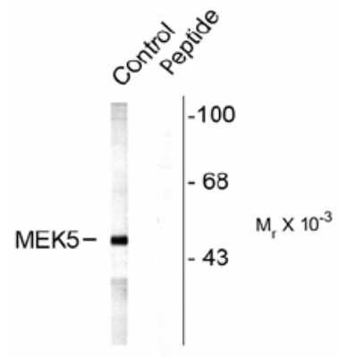 Western Blot: MEK5 [p Ser311, p Thr315] Antibody [NB100-61105] - Rat testes lysate showing specific labeling of the ~49k MEK5 protein (Control). Immunolabeling is blocked by preadsorption with the phospho-peptide used as antigen (Peptide) but not by the corresponding dephospho-peptide (not shown).